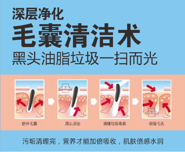 厲害了，我用【毛囊清潔術】促成了一段姻緣...