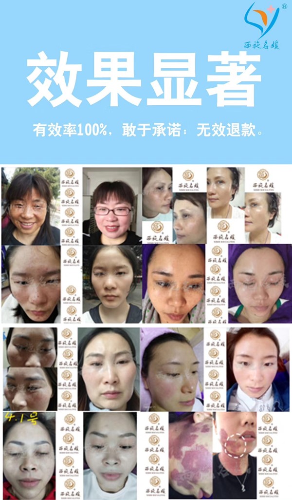 盛會開啟丨西施名媛攜2019美業最火三大項目，等你約會呀！