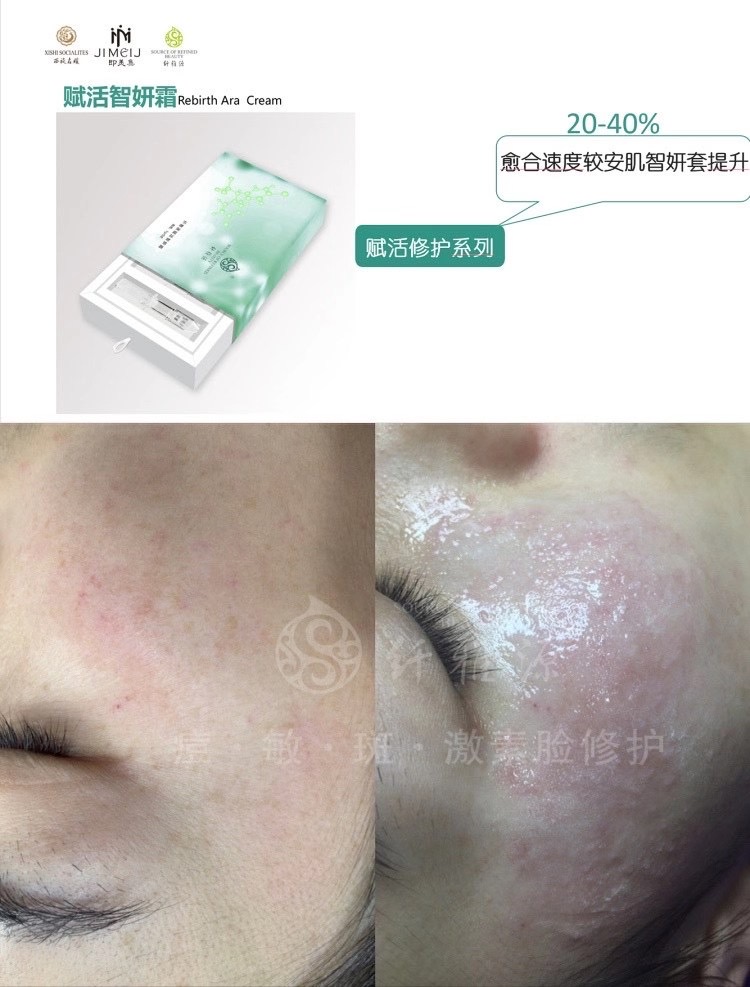 新年新品丨王牌技術再升級，祛斑更簡單了。