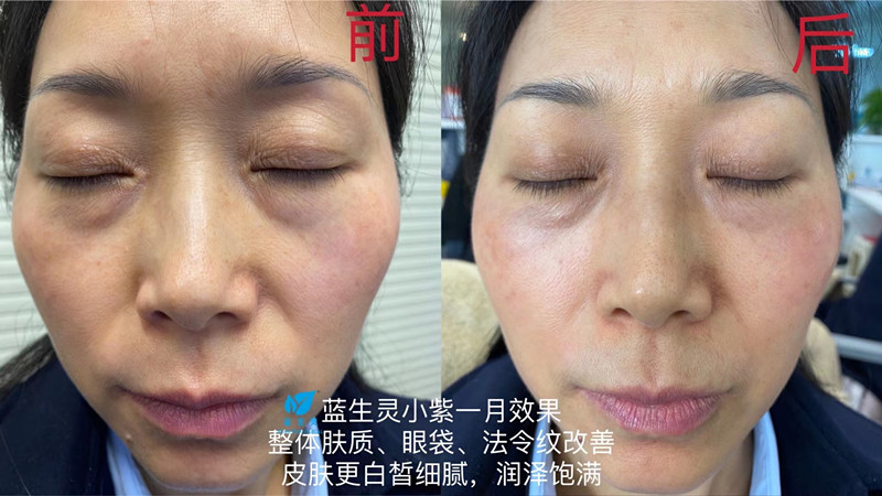 重磅新品丨一月換膚！她們是吃了美顏相機吧？？