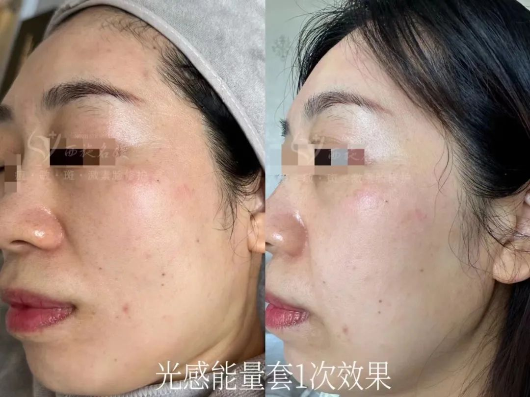 新品速遞丨拓客王者，升級回歸
